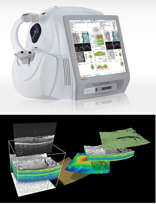 3D Eye Scan - Optical Coherence Tomography (OCT) 